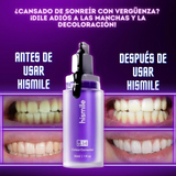 HISMILE - BLANQUEADOR DENTAL